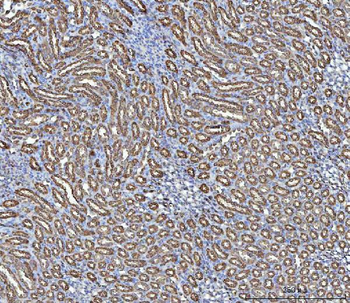 NIT2 Rabbit Polyclonal Antibody