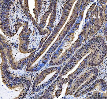 NCOA5 Rabbit Polyclonal Antibody
