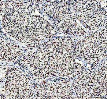 NCOA5 Rabbit Polyclonal Antibody
