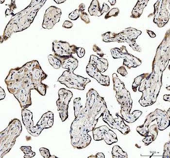 NCOA5 Rabbit Polyclonal Antibody