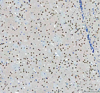 NCOA5 Rabbit Polyclonal Antibody