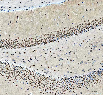 NCOA5 Rabbit Polyclonal Antibody