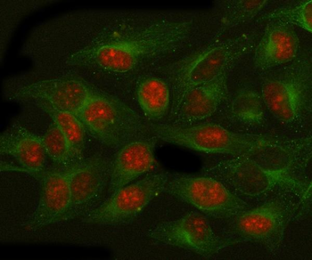 NAT10 Rabbit Polyclonal Antibody