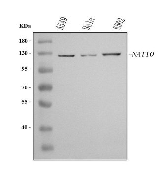 NAT10 Rabbit Polyclonal Antibody