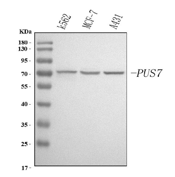 PUS7 Rabbit Polyclonal Antibody