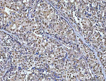 CHD8 Rabbit Polyclonal Antibody