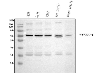 TTC39B Rabbit Polyclonal Antibody