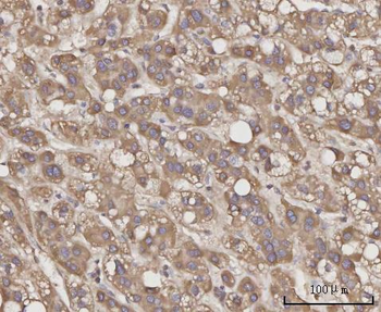 CCL23 Rabbit Polyclonal Antibody
