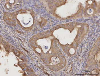 CCL23 Rabbit Polyclonal Antibody
