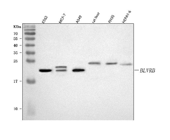 BLVRB Rabbit Polyclonal Antibody
