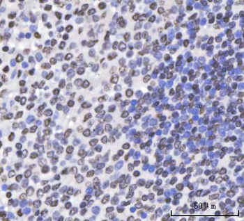 Sam68/KHDRBS1 Antibody