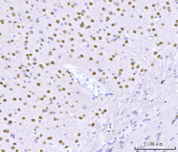 Sam68/KHDRBS1 Antibody