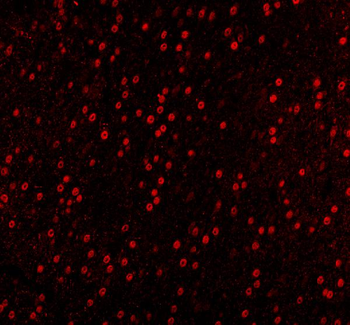 Sam68/KHDRBS1 Antibody