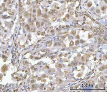 HOXD10 Rabbit Polyclonal Antibody