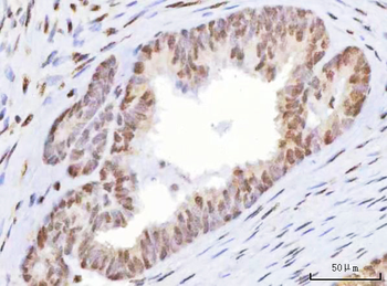 HOXD10 Rabbit Polyclonal Antibody