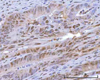 HOXD10 Rabbit Polyclonal Antibody