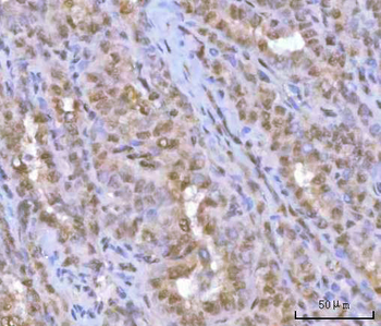HOXD10 Rabbit Polyclonal Antibody
