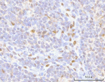 HOXD10 Rabbit Polyclonal Antibody