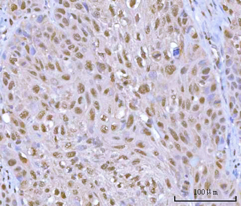 HOXD10 Rabbit Polyclonal Antibody