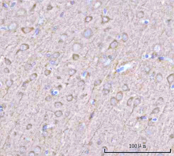 NECAB1 Rabbit Polyclonal Antibody