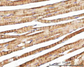 NEBL Rabbit Polyclonal Antibody