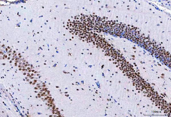 NCBP1 Rabbit Polyclonal Antibody