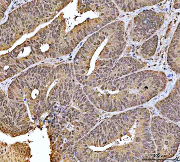 NCBP1 Rabbit Polyclonal Antibody