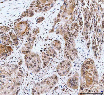 NCBP1 Rabbit Polyclonal Antibody