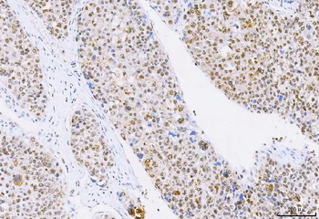 NCBP1 Rabbit Polyclonal Antibody
