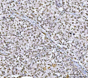 NCBP1 Rabbit Polyclonal Antibody