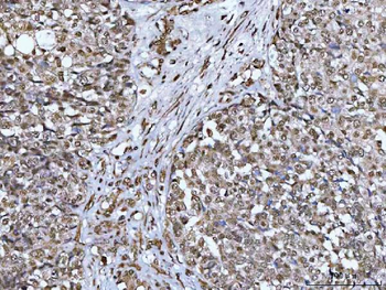 NCBP1 Rabbit Polyclonal Antibody