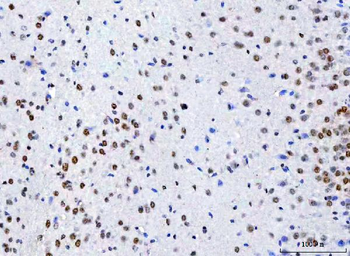 NCBP1 Rabbit Polyclonal Antibody