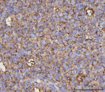 NDUFA4 Rabbit Polyclonal Antibody