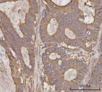 PRDM2 Rabbit Polyclonal Antibody