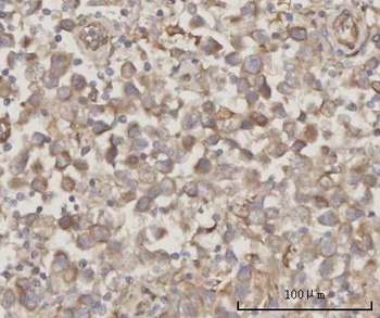PRDM2 Rabbit Polyclonal Antibody