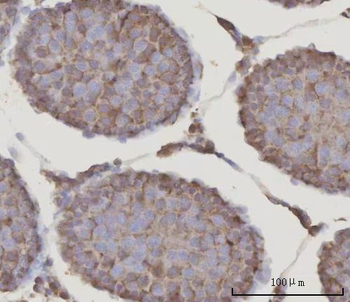 PRDM2 Rabbit Polyclonal Antibody