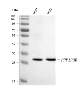 PPP1R3B Rabbit Polyclonal Antibody