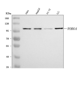 ROBO4 Rabbit Polyclonal Antibody