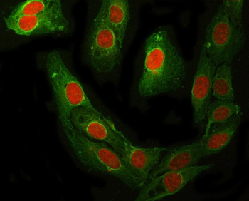 RFC4 Rabbit Polyclonal Antibody