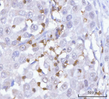 PRTN3 Rabbit Polyclonal Antibody