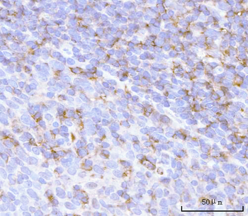 PRTN3 Rabbit Polyclonal Antibody