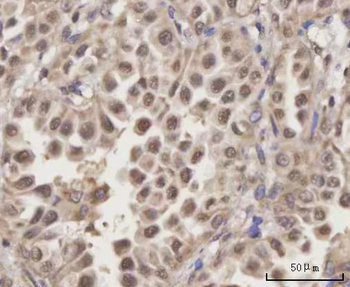 SCLY Rabbit Polyclonal Antibody