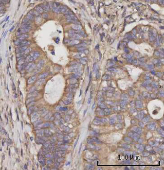 SCLY Rabbit Polyclonal Antibody