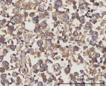 SCLY Rabbit Polyclonal Antibody