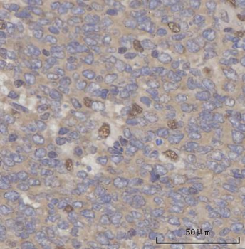 SCLY Rabbit Polyclonal Antibody