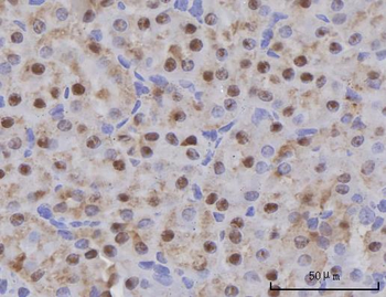 SCLY Rabbit Polyclonal Antibody