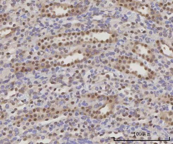 SCLY Rabbit Polyclonal Antibody