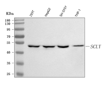 SCLY Rabbit Polyclonal Antibody
