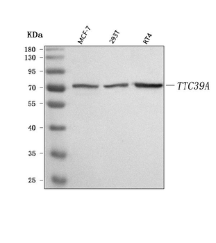 TTC39A Rabbit Polyclonal Antibody