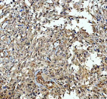 TRNT1 Rabbit Polyclonal Antibody